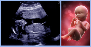 Pregnancy - The Second Trimester - Liesie Se Kind