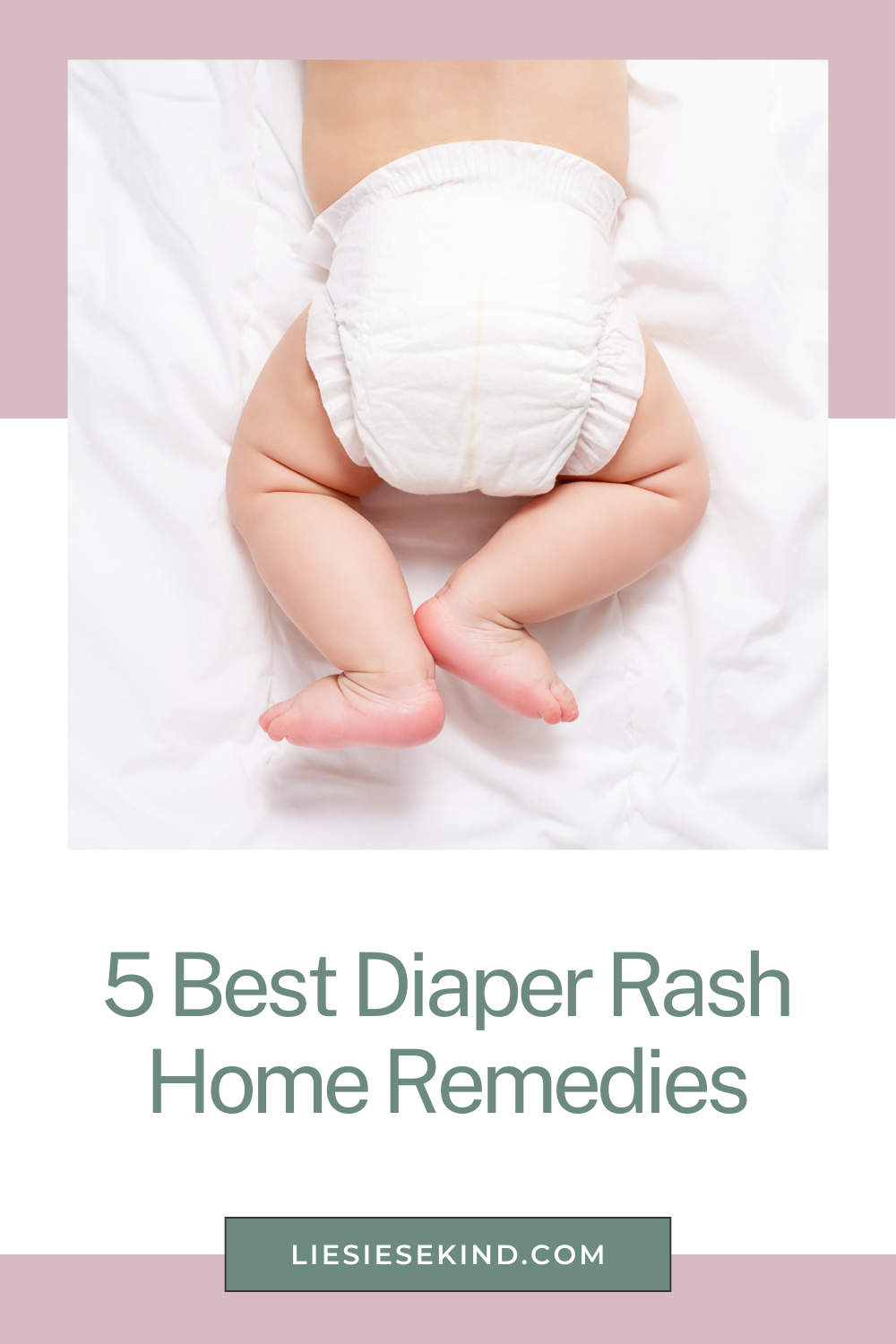 diaper rash home remedies