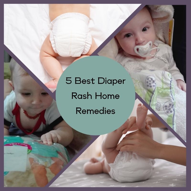 diaper rash home remedies
